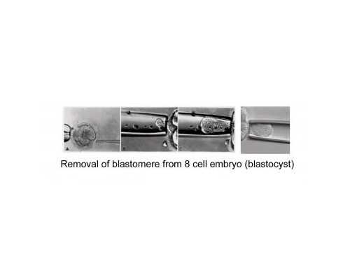 国内和供卵比较的公司,人工受精通过率低为何还要做，3类人可重点关注人工受精促孕。