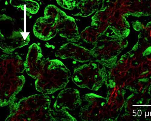 国内自卵自精代怀,天津三代试管婴儿价格，报价高的离谱都是骗局